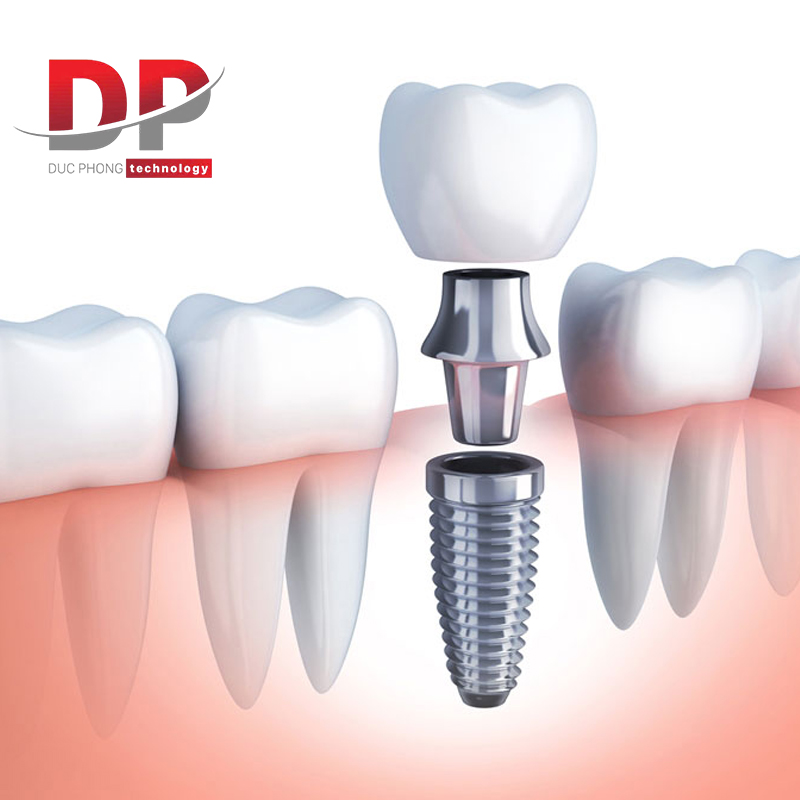 Titanium ứng dụng làm răng giả trong y tế